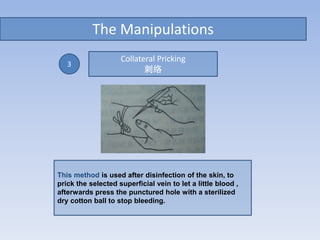 The Manipulations
This method is used after disinfection of the skin, to
prick the selected superficial vein to let a little blood ,
afterwards press the punctured hole with a sterilized
dry cotton ball to stop bleeding.
3
Collateral Pricking
刺络
 