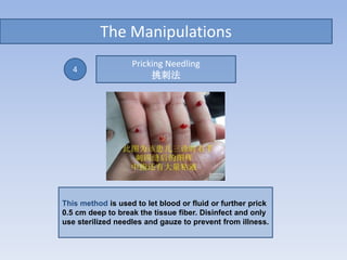 The Manipulations
This method is used to let blood or fluid or further prick
0.5 cm deep to break the tissue fiber. Disinfect and only
use sterilized needles and gauze to prevent from illness.
4
Pricking Needling
挑刺法
 