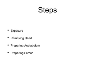 Steps
• Exposure
• Removing Head
• Preparing Acetabulum
• Preparing Femur
 