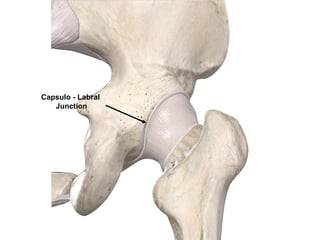 Capsulo - Labral
Junction
 