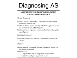 Diagnosing AS
 
