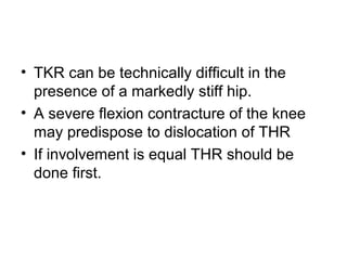 • TKR can be technically difficult in the
presence of a markedly stiff hip.
• A severe flexion contracture of the knee
may predispose to dislocation of THR
• If involvement is equal THR should be
done first.
 
