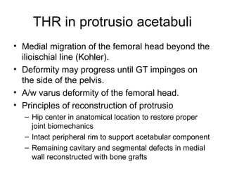 THR in protrusio acetabuli
• Medial migration of the femoral head beyond the
ilioischial line (Kohler).
• Deformity may progress until GT impinges on
the side of the pelvis.
• A/w varus deformity of the femoral head.
• Principles of reconstruction of protrusio
– Hip center in anatomical location to restore proper
joint biomechanics
– Intact peripheral rim to support acetabular component
– Remaining cavitary and segmental defects in medial
wall reconstructed with bone grafts
 