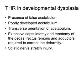 THR in developmental dysplasia
• Presence of false acetabulum.
• Poorly developed acetabulum.
• Transverse orientation of acetabulum.
• Extensive capsulotomy and tenotomy of
the psoas, rectus femoris and adductors
required to correct the deformity.
• Sciatic nerve stretch injury.
 