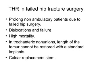THR in failed hip fracture surgery
• Prolong non ambulatory patients due to
failed hip surgery.
• Dislocations and failure
• High mortality.
• In trochanteric nonunions, length of the
femur cannot be restored with a standard
implants.
• Calcar replacement stem.
 