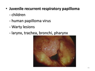 • Juvenile recurrent respiratory papilloma
- children
- human papilloma virus
- Warty lesions
- larynx, trachea, bronchi, pharynx
43
 