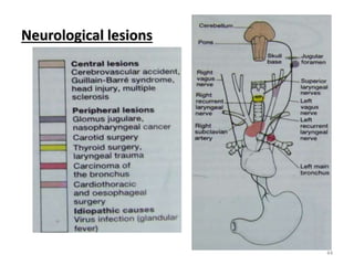 Neurological lesions
44
 