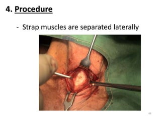 - Strap muscles are separated laterally
4. Procedure
66
 