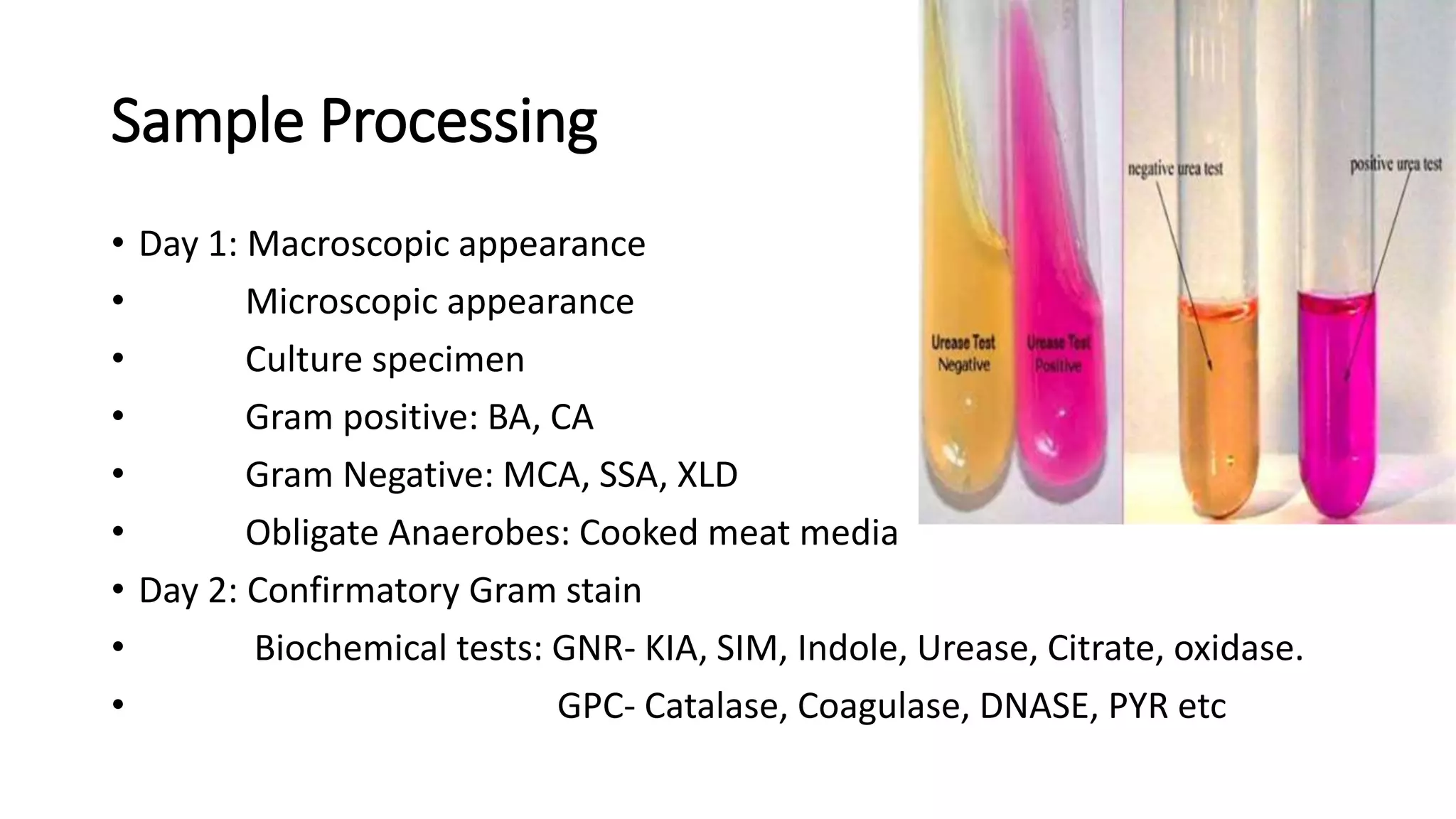 Throat Swab, Sputum and Pus.pptx