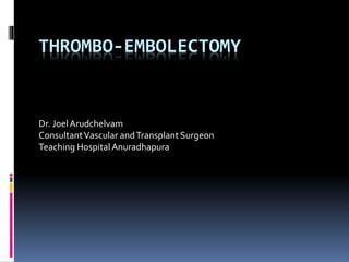 THROMBO-EMBOLECTOMY
Dr. JoelArudchelvam
ConsultantVascular andTransplant Surgeon
Teaching HospitalAnuradhapura
 