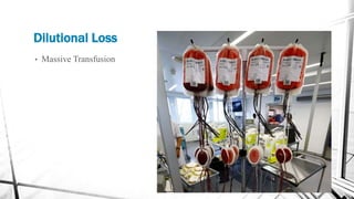 Dilutional Loss
• Massive Transfusion
 