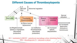 Different Causes of Thrombocytopenia
IL3 = interleukin3; GMCSF = granulocyte macrophage colony stimulating factor;
TPO = thrombopoietin; X = abnormal or absent
 