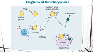 Drug induced Thrombocytopenia
 
