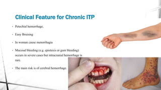 Clinical Feature for Chronic ITP
• Petechial hemorrhage,
• Easy Bruising
• In woman cause menorrhagia
• Mucosal bleeding (e.g. epistaxis or gum bleeding)
occurs in severe cases but intracranial hemorrhage is
rare.
• The main risk is of cerebral hemorrhage.
 