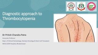 Diagnostic approach to
Thrombocytopenia
Dr Pritish Chandra Patra
Associate Professor
Dept. of Clinical Hematology, Hemato-Oncology & Stem Cell Transplant
IMS & SUM Hospital, Bhubaneswar
 
