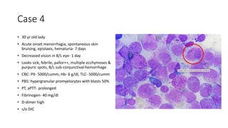 Case 4
• 30 yr old lady
• Acute onset menorrhagia, spontaneous skin
bruising, epistaxis, hematuria- 7 days
• Decreased vision in B/L eye- 1 day
• Looks sick, febrile, pallor++, multiple ecchymoses &
purpuric spots, B/L sub-conjunctival hemorrhage
• CBC: Plt- 5000/cumm, Hb- 6 g/dl, TLC- 5000/cumm
• PBS: hypergranular promyelocytes with blasts 50%
• PT, aPTT- prolonged
• Fibrinogen- 40 mg/dl
• D-dimer high
• s/o DIC
 