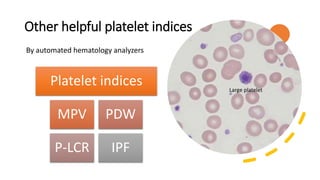 Other helpful platelet indices
Platelet indices
MPV PDW
P-LCR IPF
By automated hematology analyzers
Large platelet
 