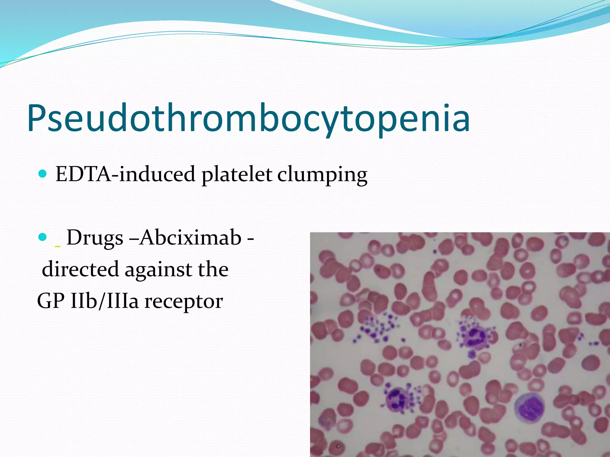 A Cause Of Thrombocytopenia Includes Quizlet - nwi65p6