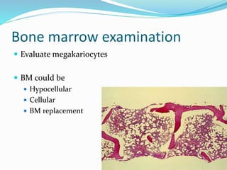 Bone marrow examination
 Evaluate megakariocytes
 BM could be
 Hypocellular
 Cellular
 BM replacement
 