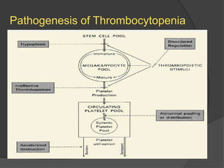 Pathogenesis of Thrombocytopenia
 