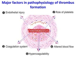 Major factors in pathophysiology of thrombus
formation
 