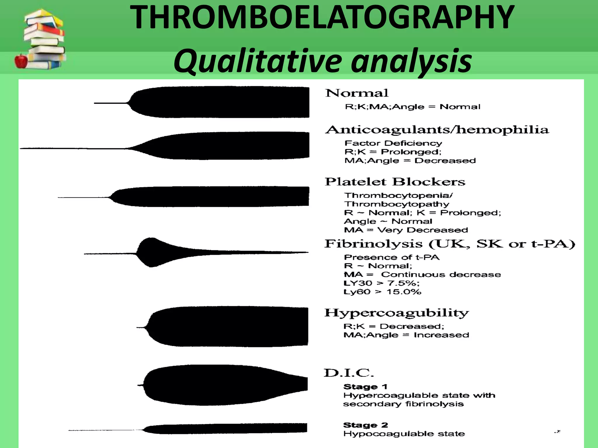 THROMBOELATOGRAPHY 
Qualitative analysis 
 