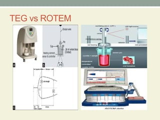 Teg Testing Comprehensive Overview of Thromboelastography (TEG) and Rotational ...