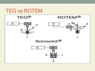 Teg Rotem Machine Comprehensive Overview of Thromboelastography (TEG) and Rotational ...