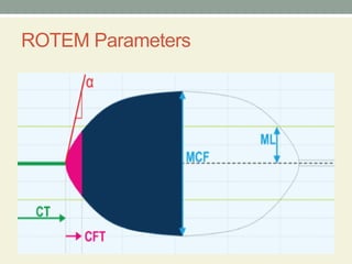 Comprehensive Overview of Thromboelastography (TEG) and Rotational ...