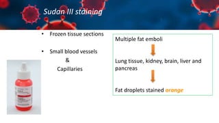 Sudan III staining
• Frozen tissue sections
• Small blood vessels
&
Capillaries
Multiple fat emboli
Lung tissue, kidney, brain, liver and
pancreas
Fat droplets stained orange
 
