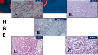 H
&
E
LUNG
PANCREAS
KIDNEY
BRAIN
LIVER
 