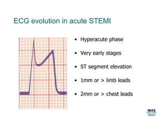 Thrombolysis | PPT