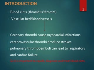  Blood clots (thrombus/thrombi)
2
 Vascular bed/Blood vessels
 Coronary thrombi cause myocardial infarctions
 cerebrovascular thrombi produce strokes
 pulmonary thromboemboli can lead to respiratory
and cardiac failure
 So it is important to rapidly diagnose and treat blood clots.
 