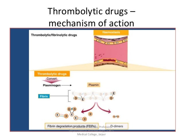 Thrombolytics or Fibrinolytics