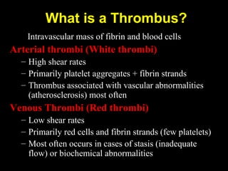 What is a Thrombus?
Intravascular mass of fibrin and blood cells
Arterial thrombi (White thrombi)
– High shear rates
– Primarily platelet aggregates + fibrin strands
– Thrombus associated with vascular abnormalities
(atherosclerosis) most often
Venous Thrombi (Red thrombi)
– Low shear rates
– Primarily red cells and fibrin strands (few platelets)
– Most often occurs in cases of stasis (inadequate
flow) or biochemical abnormalities
 