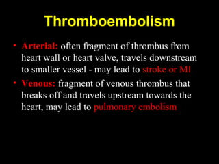 Thromboembolism
• Arterial: often fragment of thrombus from
heart wall or heart valve, travels downstream
to smaller vessel - may lead to stroke or MI
• Venous: fragment of venous thrombus that
breaks off and travels upstream towards the
heart, may lead to pulmonary embolism
 