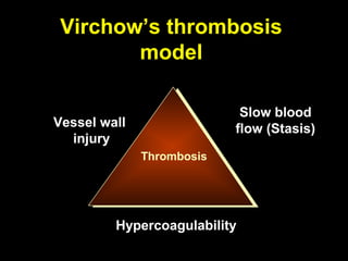 Virchow’s thrombosis
model
Thrombosis
Vessel wall
injury
Slow blood
flow (Stasis)
Hypercoagulability
 