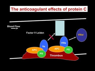 VIIIai
The anticoagulant effects of protein C
Blood Flow
VIIIa
Va
Thrombus
Vai
APC
APC
PS
PS
Factor V Leiden
 