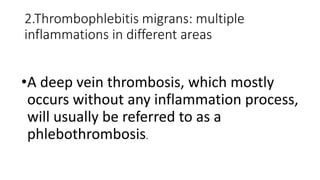 2.Thrombophlebitis migrans: multiple
inflammations in different areas
•A deep vein thrombosis, which mostly
occurs without any inflammation process,
will usually be referred to as a
phlebothrombosis.
 