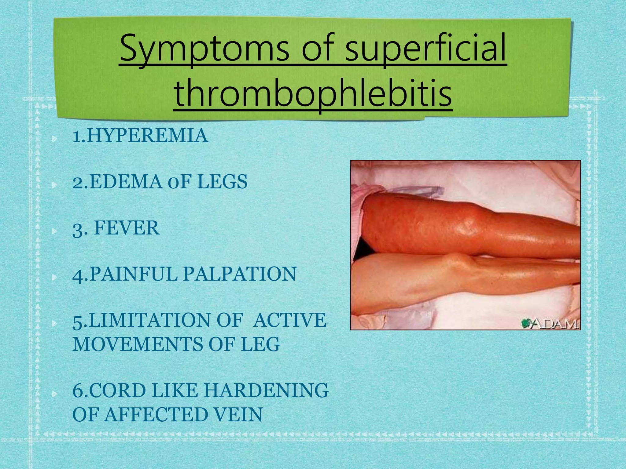 Thrombophlebitis and DVT ppt | PPTX
