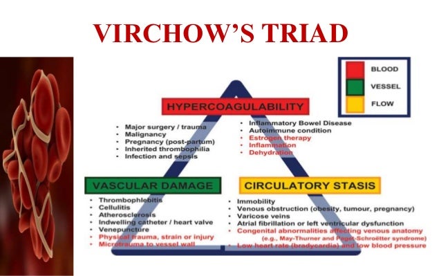 Virchows Triad