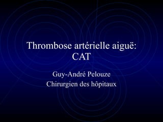 Thrombose artérielle aiguë: CAT Guy-André Pelouze Chirurgien des hôpitaux 