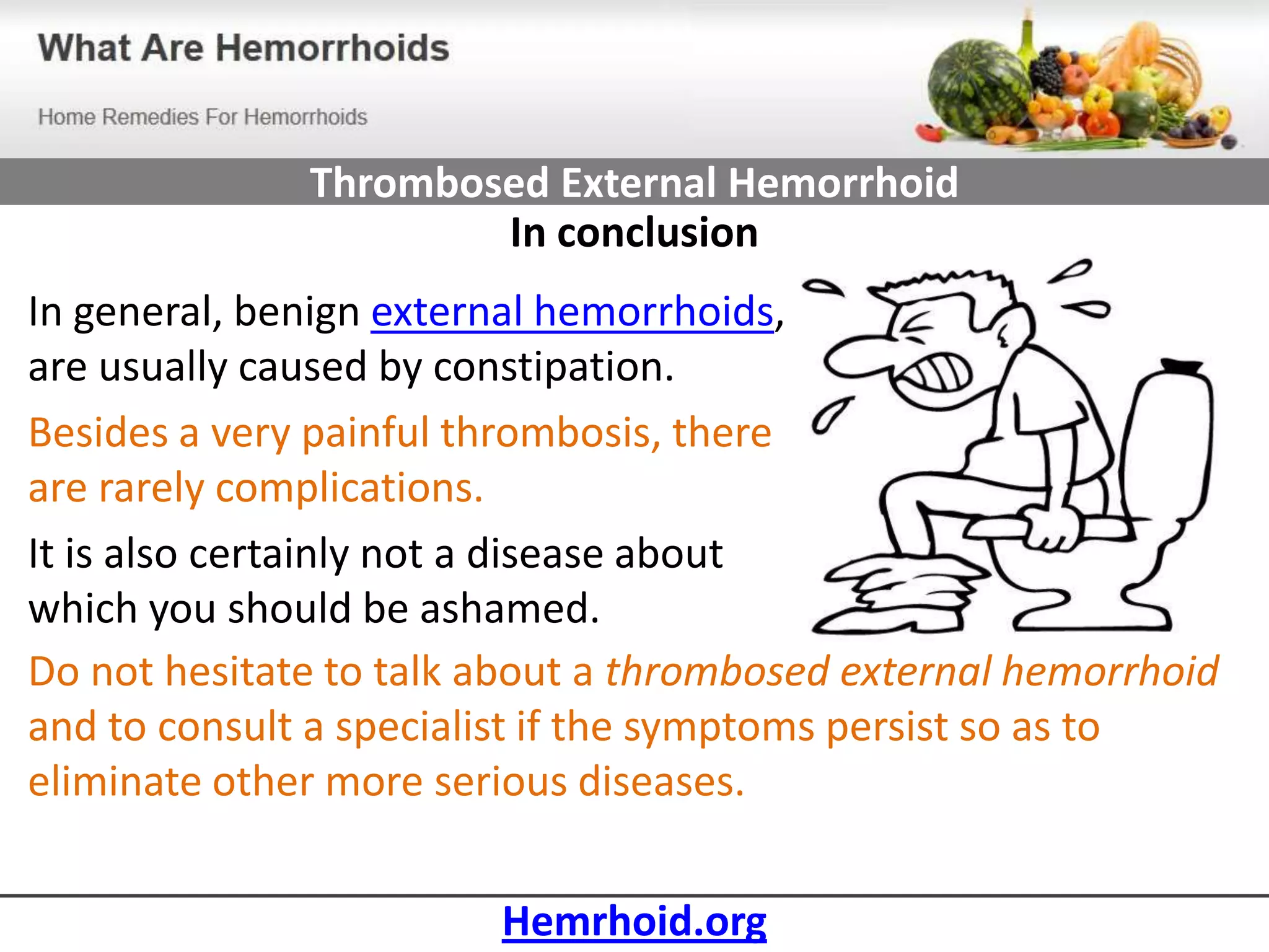 thrombosed-external-hemorrhoid-pptx
