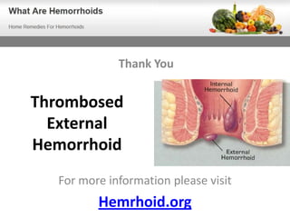 Thank You


Thrombosed
  External
Hemorrhoid
  For more information please visit
         Hemrhoid.org
 