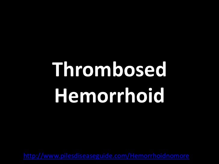 Thrombosed hemorrhoid