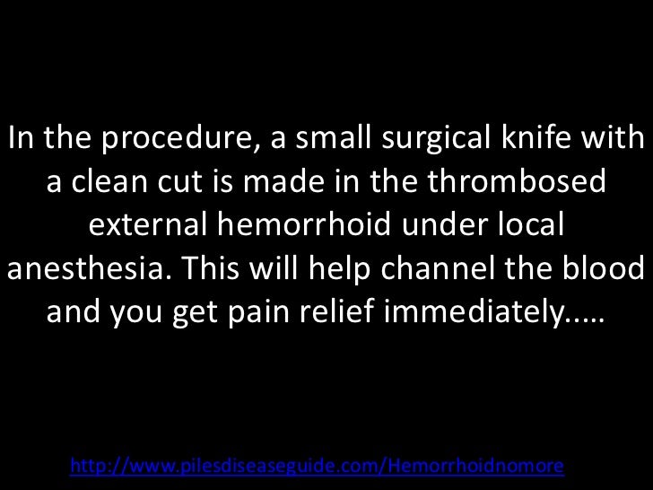 Thrombosed hemorrhoid