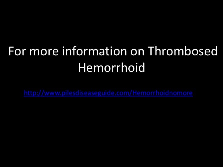 Thrombosed hemorrhoid