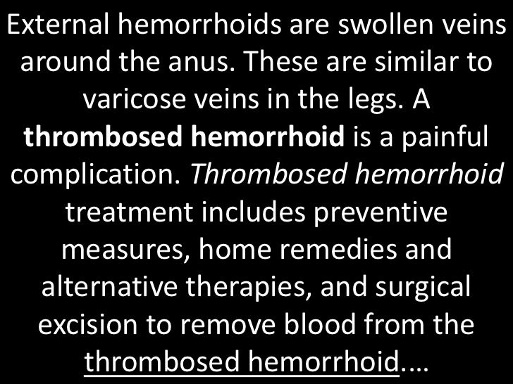Thrombosed hemorrhoid