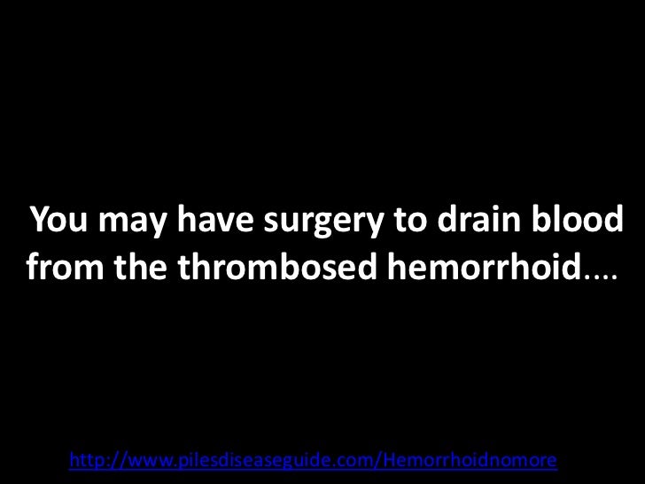 Thrombosed hemorrhoid