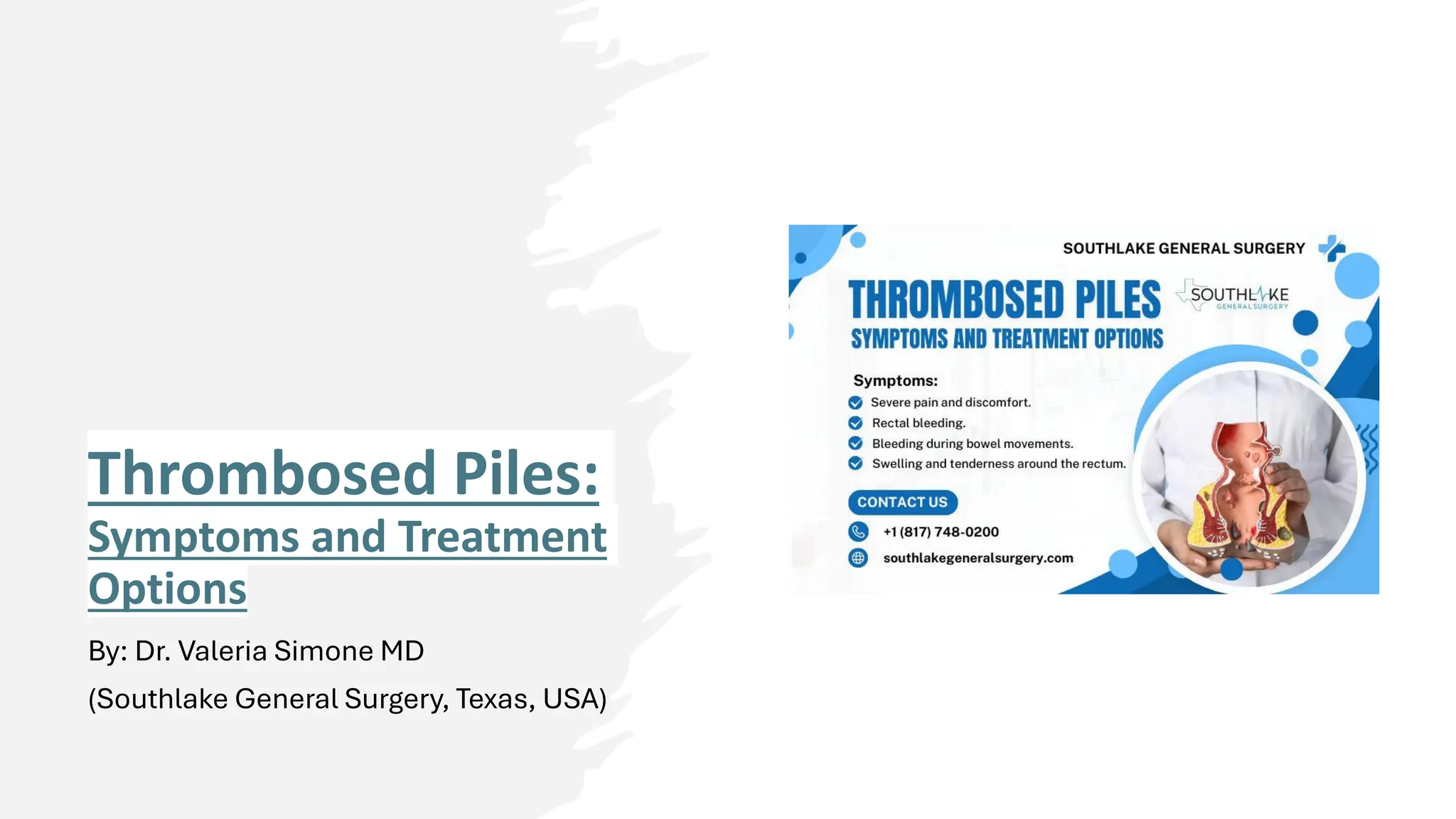 Thrombosed Piles Symptoms and Treatment Options.pdf